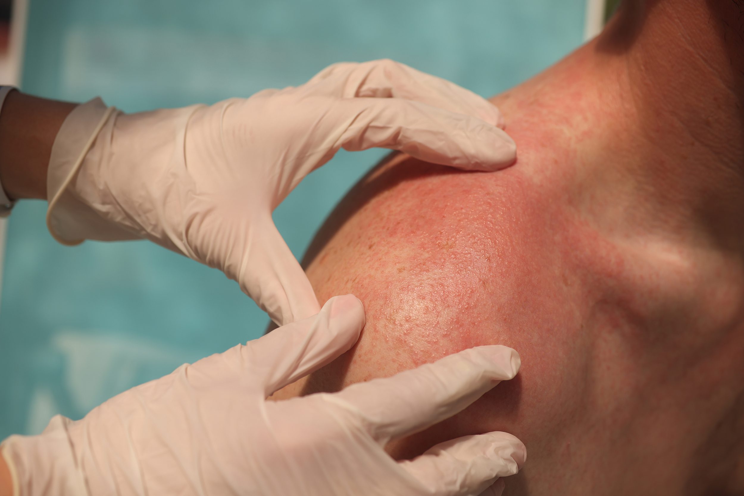Getting the Most from Your Dermatologist Appointment